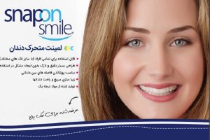 لمینت متحرک دندان – Snap On Smile